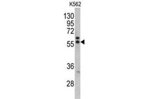 Western blot analysis of MAPE antibody (C-term) in K562 cell line lysates (35ug/lane). (PRAME anticorps  (C-Term))