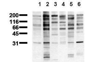Western Blotting (WB) image for anti-Phosphotyrosine antibody (ABIN126879) (Phosphotyrosine anticorps)