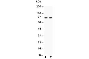 Western blot testing of Cadherin 17 antibody and Lane 1:  HeLa (LI Cadherin anticorps  (AA 686-699))