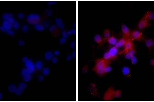 Human hepatocellular carcinoma cell line Hep G2 was stained with Rabbit IgG-UNLB isotype control, and DAPI. (TNFRSF10B anticorps)