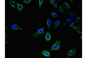 anti-Ubiquitin-Like Modifier Activating Enzyme 6 (UBA6) (AA 1-44) antibody