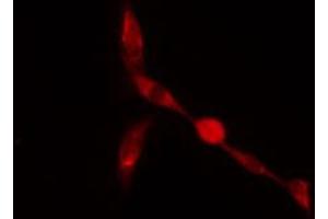 ABIN6274261 staining A549 cells by IF/ICC. (ZFP36L2 anticorps  (Internal Region))