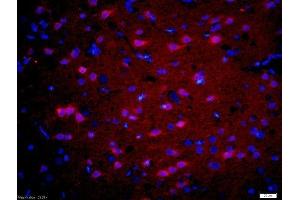 Formalin-fixed and paraffin-embedded rat brain labeled with Rabbit Anti-GnRHR Polyclonal Antibody, Unconjugatedused at 1:200 dilution for 40 minutes at 37°C.