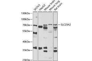 Western blot analysis of extracts of various cell lines, using SLC23 antibody (ABIN6133021, ABIN6147898, ABIN6147899 and ABIN6222467) at 1:1000 dilution.