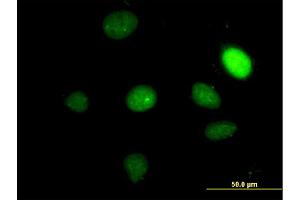 Immunofluorescence of monoclonal antibody to TBX2 on HeLa cell.