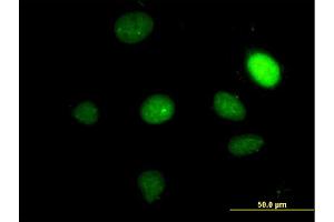 Immunofluorescence of monoclonal antibody to TBX2 on HeLa cell. (TBX2 anticorps  (AA 603-702))