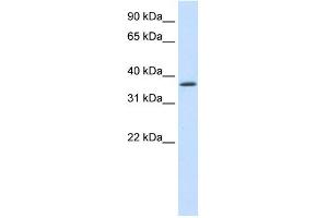 WB Suggested Anti-SAP30BP Antibody Titration:  1. (SAP30BP anticorps  (C-Term))