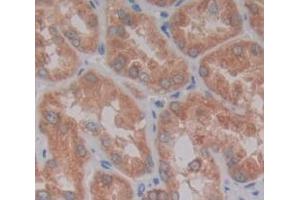 Used in DAB staining on fromalin fixed paraffin- embedded Kidney tissue (SPRED2 anticorps  (AA 1-418))