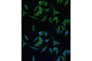 Immunofluorescence analysis of L929 cells using CNNM1 antibody (ABIN7266572) at dilution of 1:100.