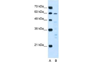 WB Suggested Anti-IL10RA Antibody Titration:  5. (IL-10RA anticorps  (N-Term))