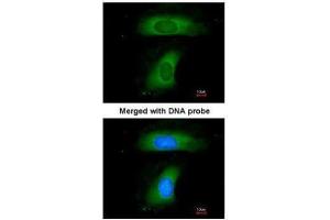 ICC/IF Image Immunofluorescence analysis of paraformaldehyde-fixed HeLa, using B-cell linker protein, antibody at 1:200 dilution. (B-Cell Linker anticorps  (C-Term))
