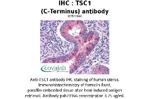 Image no. 2 for anti-Tuberous Sclerosis 1 (TSC1) (C-Term) antibody (ABIN1740408)