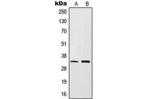 Western blot analysis of CD20 expression in BJAB (A), Ramos (B) whole cell lysates. (CD20 anticorps  (C-Term))