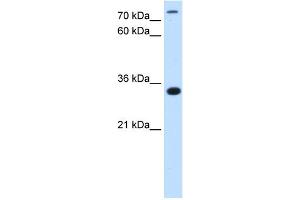 WB Suggested Antibody Titration:  2. (TAM41 anticorps  (N-Term))