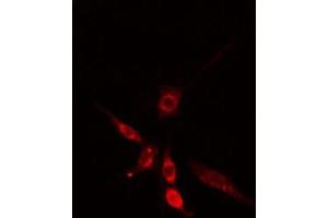 ABIN6275698 staining  HepG2 cells by IF/ICC. (SLC30A9 anticorps  (Internal Region))