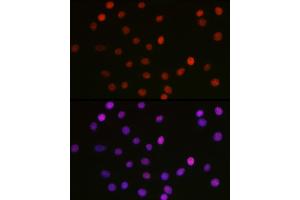 Immunofluorescence analysis of C6 cells using [KO Validated] Acetyl-HMGB1-K29 Rabbit pAb (ABIN7267647) at dilution of 1:100 (40x lens).