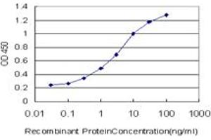 anti-Uridine Monophosphate Synthetase (UMPS) (AA 381-479) antibody