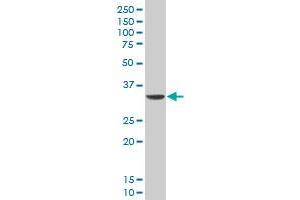 DLX5 monoclonal antibody (M12), clone 3B11 Western Blot analysis of DLX5 expression in A-431 .