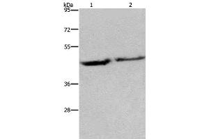 Western Blot analysis of Human adrenal pheochromocytoma and fetal brain tissue using EIF3H Polyclonal Antibody at dilution of 1:1150 (EIF3H anticorps)