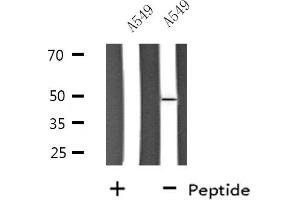Western blot analysis of extracts from A549 cells, using SLC30A4 antibody. (SLC30A4 anticorps  (Internal Region))
