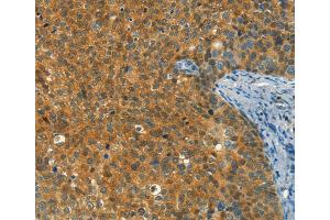 Immunohistochemistry (IHC) image for anti-DIRAS Family, GTP-Binding RAS-Like 1 (DIRAS1) antibody (ABIN2432953) (DIRAS1 anticorps)