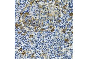 Immunohistochemistry of paraffin-embedded human tonsil using HSPH1 antibody. (HSPH1 anticorps  (AA 659-858))