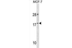 Western Blotting (WB) image for anti-Cyclin-Dependent Kinase 2 Associated Protein 2 (CDK2AP2) antibody (ABIN3000904) (CDK2AP2 anticorps)
