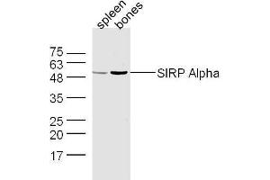 Mouse spleen and bone lysates probed with Rabbit Anti-SIRP Alpha Polyclonal Antibody, Unconjugated  at 1:500 for 90 min at 37˚C. (SIRPA anticorps  (AA 151-250))