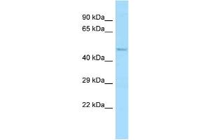 WB Suggested Anti-Abi1 Antibody Titration: 1. (ABI1 anticorps  (N-Term))