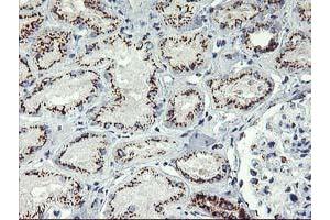 Image no. 10 for anti-Golgi Membrane Protein 1 (GOLM1) antibody (ABIN1498491)