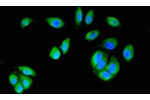 Immunofluorescent analysis of A549 cells using ABIN7146988 at dilution of 1:100 and Alexa Fluor 488-congugated AffiniPure Goat Anti-Rabbit IgG(H+L)