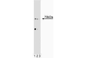 Western blot analysis of 5-Lipoxygenase on SL-29 lysate. (ALOX5 anticorps  (AA 442-590))