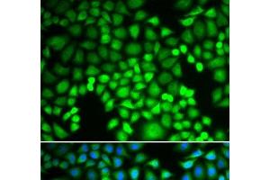 Immunofluorescence analysis of U2OS cells using PSMA4 Polyclonal Antibody (PSMA4 anticorps)
