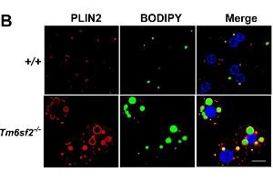 Localization of TM6SF2 and neutral lipids in mouse primary hepatocytes.