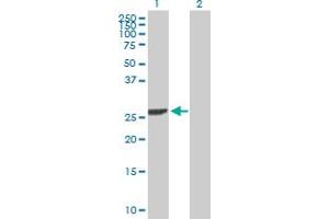 Western Blot analysis of DCK expression in transfected 293T cell line by DCK MaxPab polyclonal antibody. (DCK anticorps  (AA 1-260))