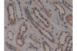 Detection of COIL in Human Kidney Tissue using Polyclonal Antibody to Coilin (COIL)