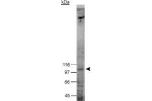 Western blot analysis of NOD2 in NOD2 transfected HEK 293T (Bosc 23) cell lysate with NOD2 monoclonal antibody, clone 2D9 . (NOD2 anticorps  (AA 28-301))