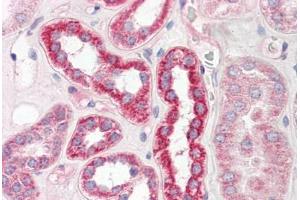 Image no. 2 for anti-Plastin 3 (PLS3) (AA 503-552) antibody (ABIN6749763) (Plastin 3 anticorps  (AA 503-552))