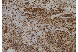 ABIN6273396 at 1/100 staining Human spleen tissue by IHC-P. (SLC5A5 anticorps  (Internal Region))