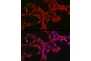 Immunofluorescence analysis of PC-12 cells using LTBR Rabbit pAb (ABIN6129412, ABIN6143379, ABIN6143381 and ABIN6220987) at dilution of 1:200 (40x lens). (LTBR anticorps  (AA 31-227))