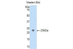 Western Blotting (WB) image for anti-gamma Glutamyltransferase 1 (GGT1) (AA 122-299) antibody (ABIN1859003) (GGT1 anticorps  (AA 122-299))