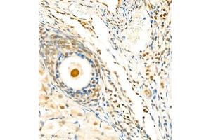 Immunohistochemistry of paraffin embedded mouse ovary using Skar (ABIN7074970) at dilution of 1:1800 (400x lens) (p46 anticorps)