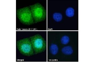 ABIN184922 Immunofluorescence analysis of paraformaldehyde fixed MCF7 cells, permeabilized with 0.