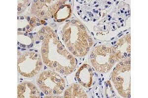 Immunohistochemical analysis of paraffin-embedded human kidney using vWF at 1:25 dilution. (VWF anticorps)