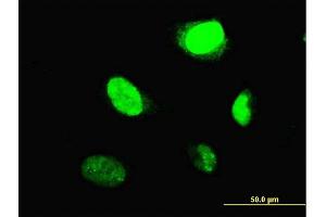 Immunofluorescence of monoclonal antibody to MYBL2 on HeLa cell.