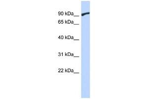 WB Suggested Anti-ZNF337 Antibody Titration:  0. (ZNF337 anticorps  (Middle Region))