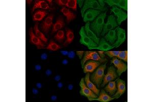 ABIN6259741 and ABIN6279518 staining Hela cells by IF/ICC. (Acsl3 anticorps  (Internal Region))
