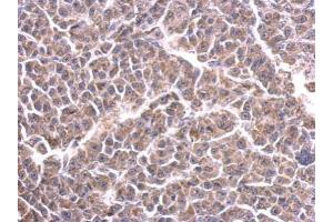 IHC-P Image Cytochrome C1 antibody detects CYC1 protein at cytosol on BT483 xenograft by immunohistochemical analysis.