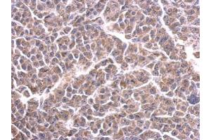 IHC-P Image Cytochrome C1 antibody detects CYC1 protein at cytosol on BT483 xenograft by immunohistochemical analysis. (Cytochrome C1 anticorps)