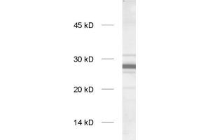 dilution: 1 : 1000, sample: rat brain homogenate (GS28 anticorps  (Cytoplasmic Domain))